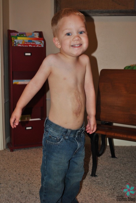A toddler with a surgical scar on his abdomen. Logo: Houston moms Blog. 