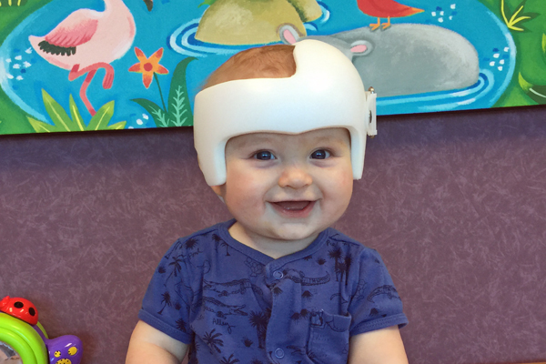A smiling baby wearing a helmet. 