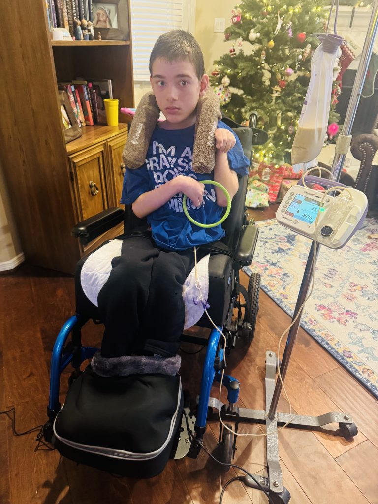 boy in wheelchair being fed by feeding tube
