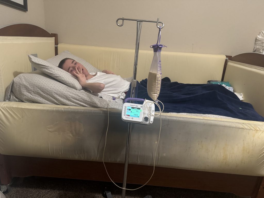 child being fed by feeding tube lays in bed