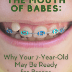 Braces (Pinterest Pin (1080 x 1920))
