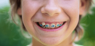 young boy with braces