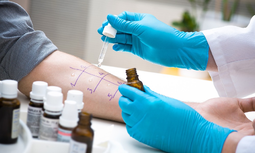 a skin prick test at a doctor's office