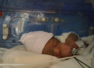 The Consequences of Pregnancy: Premature Joy preemie in incubator