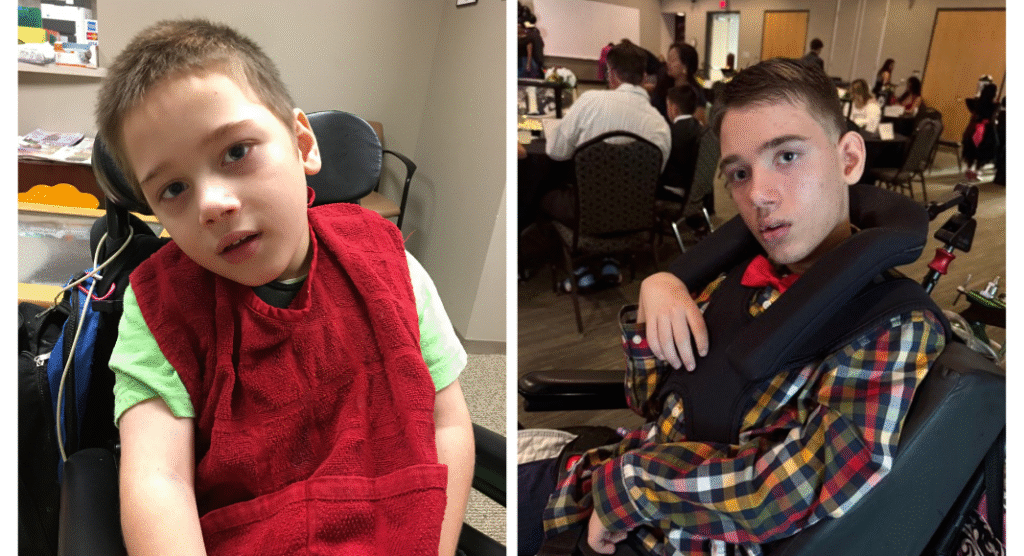 side by side of a boy at age 6 and age 15